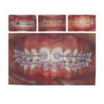 3 d打印技术如何使混合矫正治疗可能吗德赢vwinac登录