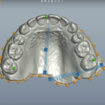 Easyrx将自由形式切割平面添加到EasyRX 3D中