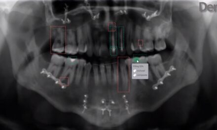 FDA Denti清理。AI Auto-Chart牙科软件
