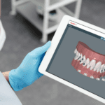 坦诚的将功能添加到CandidPro平台