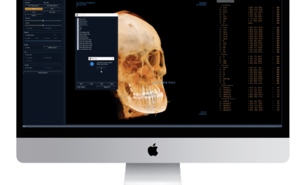 类骨质首次AI-Powered比起现场人头测量法的跟踪